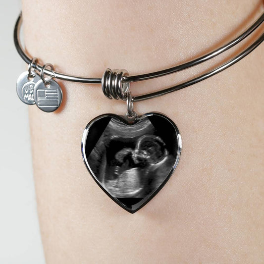 New Mom Personalized Ultrasound Bracelet - Glitter By Kate Wild